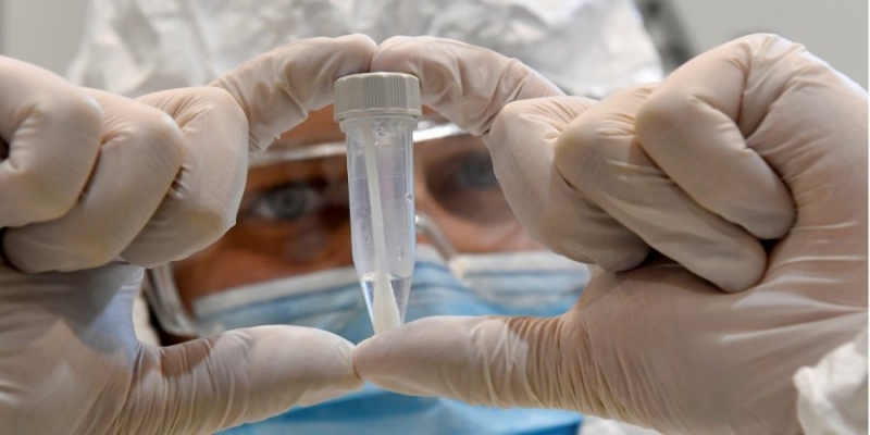 COVID-19 в Украине. За сутки зафиксировано 2472 случая инфицирования, выздоровели 7815 человек