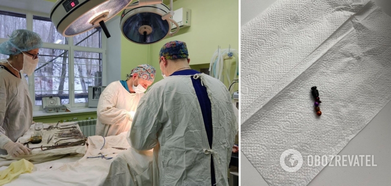 Во Львове врачи спасли двухлетнюю девочку, проглотившую магниты от конструктора. Фото